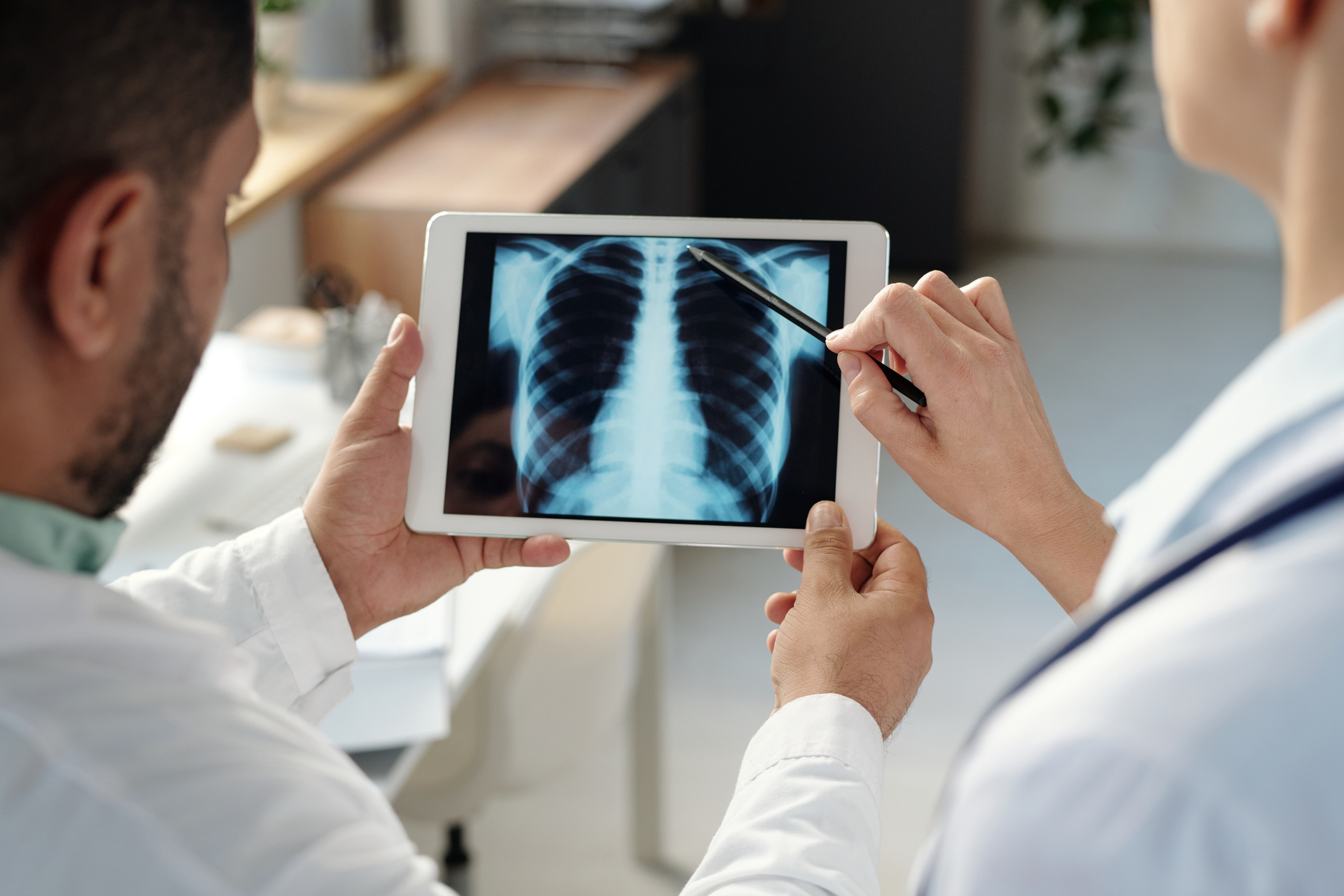 Close Up of Two Doctors Examining Chest X-Ray